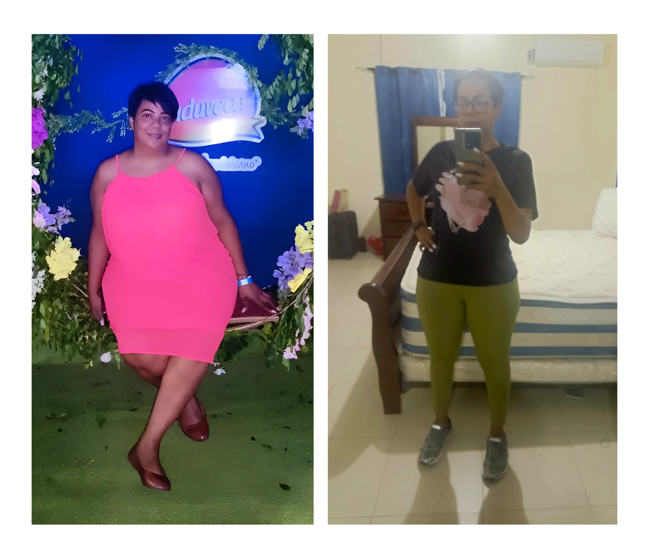 Caso de éxito 6 meses — Doctor Obesidad