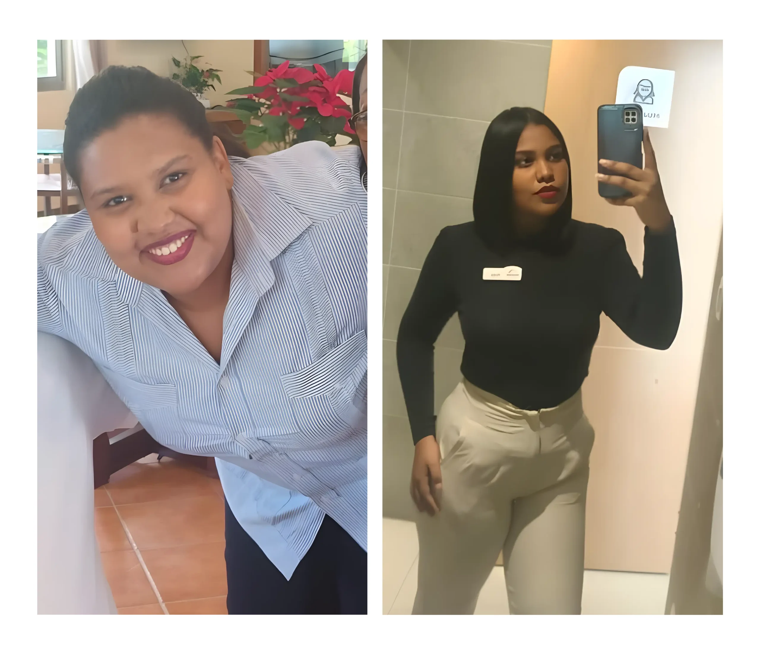 Antes y después — Caso Transformación Doctor Obesidad